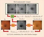 Synthethic Angiographic Fundus Imaging