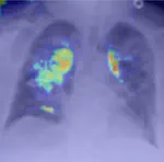 medXGAN - Visual Explanations for Medical Classifiers Through a Generative Latent Space