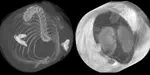 Grating-Based Phase-Contrast X-Ray Tomography