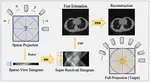 Enhancing Sparse-View CT Reconstruction with Neural Networks