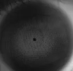 Single-Shot Deflectometry for Precise Cornea Measurement